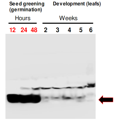 western blot using anti-RIQ1 antibodies